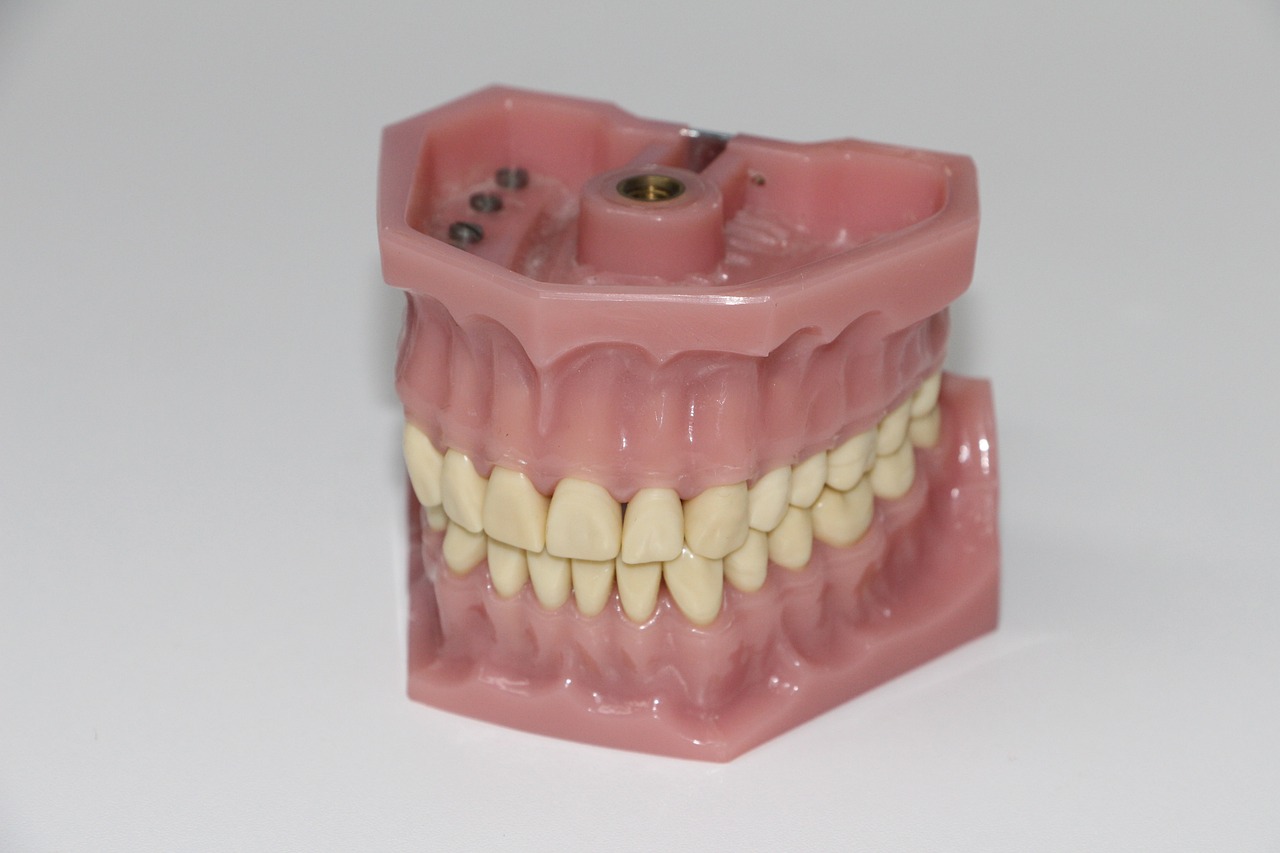 Qual o valor de 1 prótese dentária?